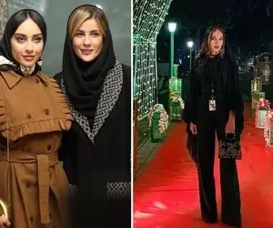 وقتی "ترلان پروانه" با صورت پر پروتز شده یکی دیگه؛ خانوم تو لایوهاش چه عجیب و جسوره!