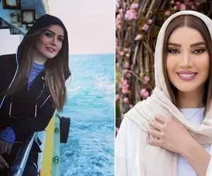 فاز شُل "متین ستوده" با میکاپ جینگول مستون؛ خانوم انگار با ماله صورتشُ صاف کرده!