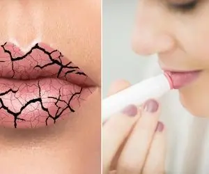 اگه لبت توی سرما خشک شده و ترک میخوره؛ بیا تا یه نسخه جادویی بهت بدم!