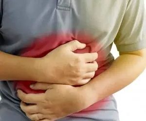 ۱۰ درمان خانگی برای زخم معده