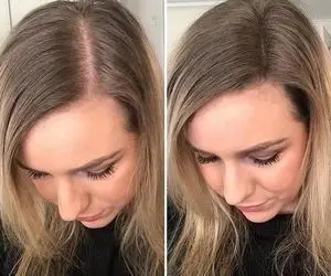 سفر به دنیای خوشگلاسیون؛ رشد سریع موهای کوتاه و بلند از تغذیه و شامپو تا ماساژ کف سر