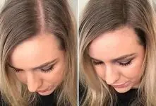 سفر به دنیای خوشگلاسیون؛ رشد سریع موهای کوتاه و بلند از تغذیه و شامپو تا ماساژ کف سر