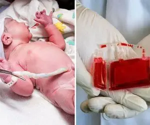 بند ناف از این به بعد دور ریخته نمی‌شود! راه درمان بیماری‌های لاعلاج کشف شد