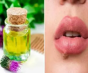 از بین بردن تبخال با روش های خانگی در 24 ساعت / معجزه ای که با این روغن رقم میخوره