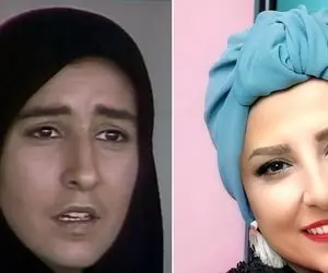 قبل و بعد مرجانه گلچین / بزنگاه مال بیست سال پیشه ولی الان بیست سال جَوون شده