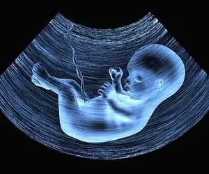 مخالفت مجلس با اجباری شدنِ غربالگری زایمان