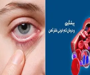 اگر این 5 نشانه رو دارید به احتمال قوی فقر آهن دارید| علامت خطری که اکثر ایرانیا دارن