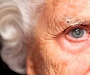 چگونه تشخیص دهیم آب مروارید داریم؟