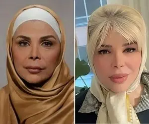 شیوا خنیاگر بازیگر عاطی جون تو اینستا چه شیکوله؛ بلوند و دود و دم و دو کیلو پروتز لبو!