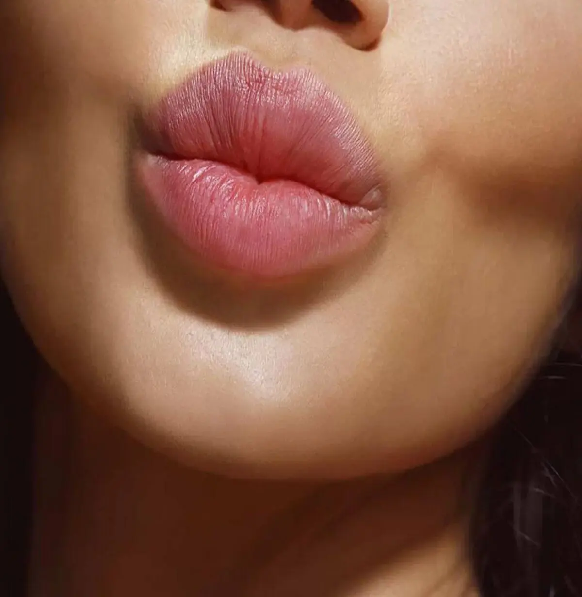 تفاوت ژل لب با فیلر