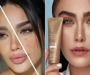 بهترین کرم پودرا برا کاور جوش و کک و مک / دو سر برد یعنی اینا که ضد آفتابم هستن عالین