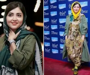 وقتی "زیبا کرمعلی" جهت خاص بازی رو مانتوش سنجاب بیچاره رو دوخت؛ چه مُخ تو مُخیه !