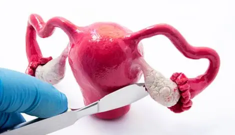 آیا می‌دانستید تخمدان و رحم شما می‌تواند دندان در بیاورد؟!