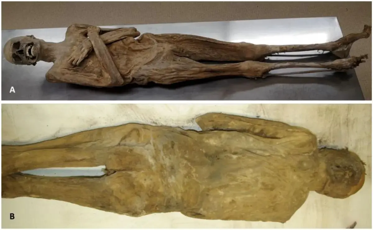 مومیایی از مقعد کشیش