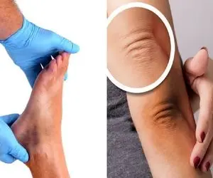 راه آسون روشن کردن نواحی تیره پوست مثل قوزک پا آرنج و زانو؛ مثل بخت سیندرلا سفیدش کن