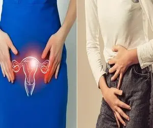 بهترین پماد برای عفونت و خارش واژن؛ پاکسازی واژن از عفونت در خانه و با خوددرمانی