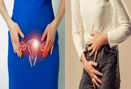 بهترین پماد برای عفونت و خارش واژن؛ پاکسازی واژن از عفونت در خانه و با خوددرمانی