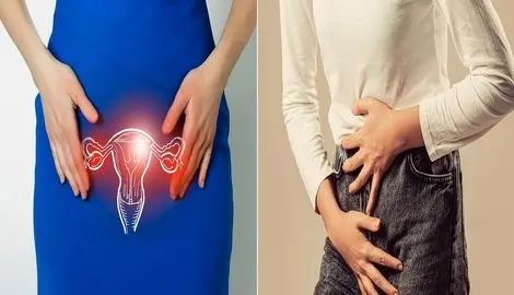 بهترین پماد برای عفونت و خارش واژن؛ پاکسازی واژن از عفونت در خانه و با خوددرمانی