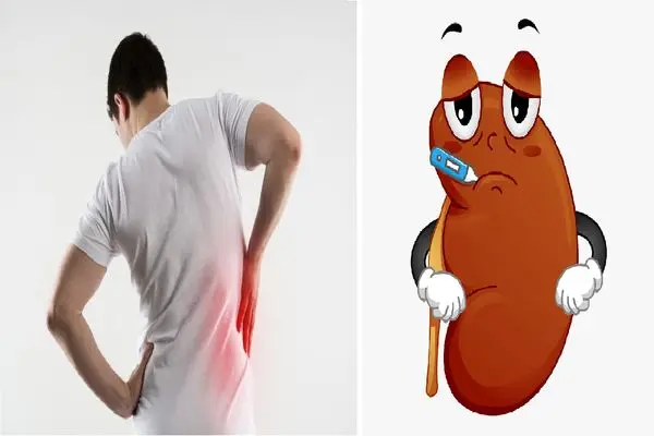 Kidney Stone Diet: Foods to Eat and Avoid