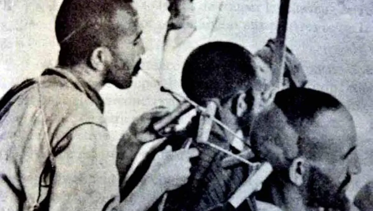 حجامت با شاخ گاو در قاجار