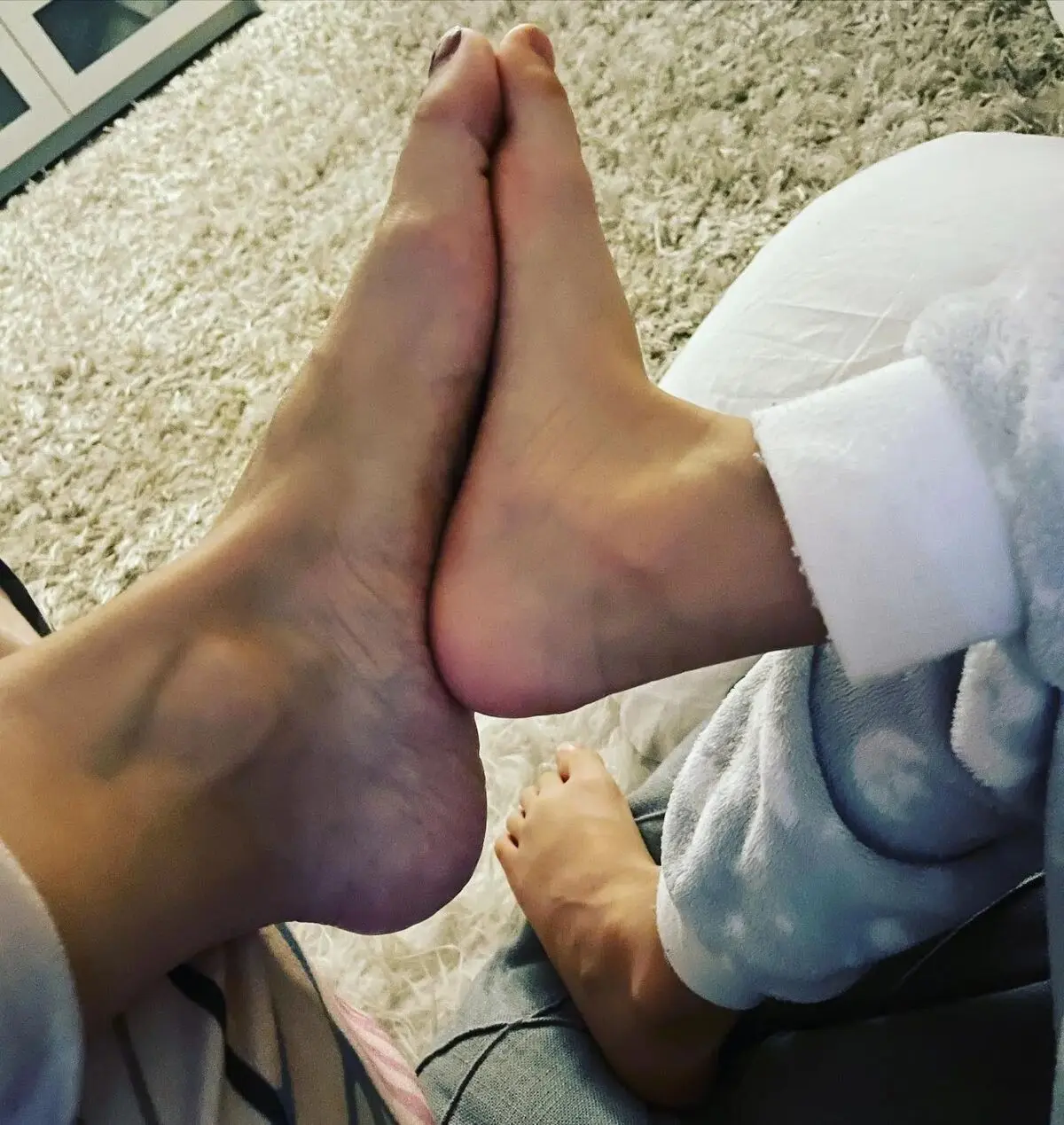 rg