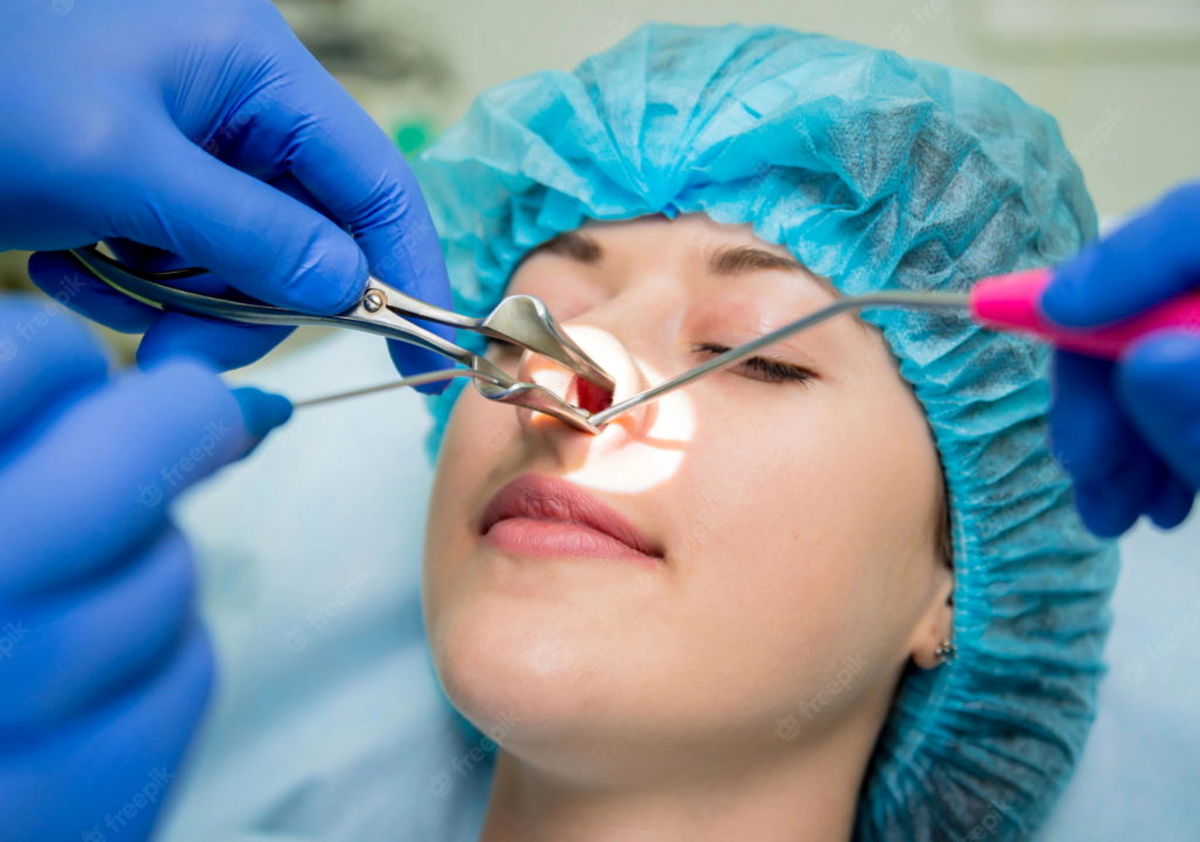 laser-vaporization-nasal-concha-with-coblation-technology-method-endoscopic-sinus-surgery_179755-7549-1024x719