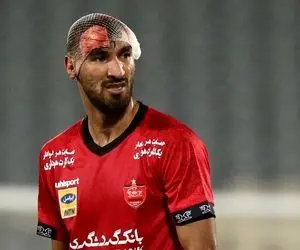 شهریار مغانلو هم دربی جام حذفی را از دست می دهد؟