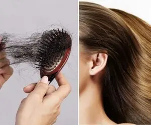 چجوری از ریزش موهامون جلوگیری کنیم؟ / بهت میگم چی بخوری تا موهات کم که نه زیاد بشه!