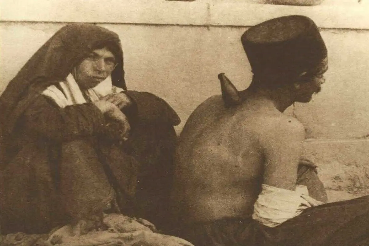 حجامت با شاخ گاو در قاجار