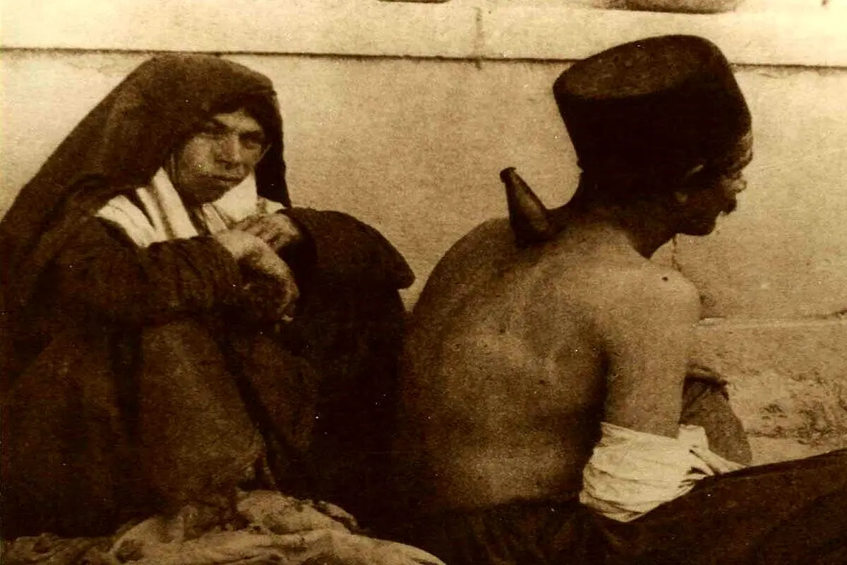 حجامت با شاخ گاو در قاجار