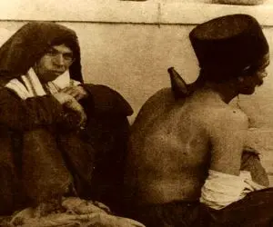 یک عکس یک روایت؛ مردی از قاجار در میان کوچه برای درمان با شاخ گاو حجامت میشود