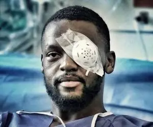 به بهانه مصدومیت تلخ یامگا؛ نگاهی به شدیدترین مصدومیت‌های فوتبال ایران