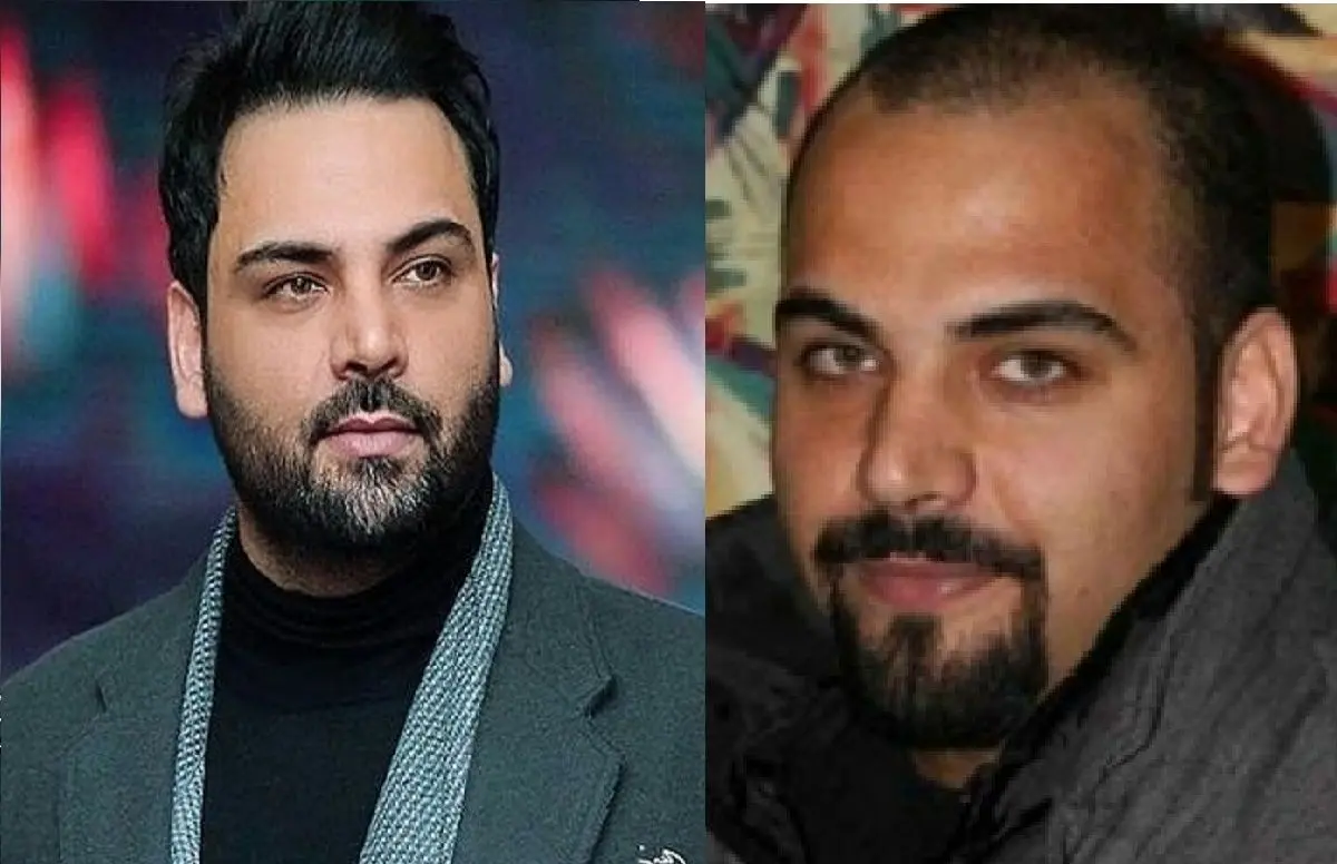 احسان علیخانی قبل از عمل بینی