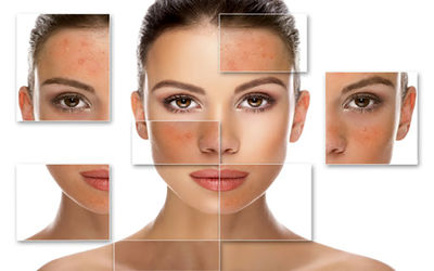 چگونه بفهمیم پوست مان حساس است و از آن مراقبت کرد؟