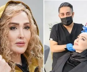 "زهره فکور" انقدر واسه تبلیغ رفت زیر دست دکترا که...؛ آشپز چنتا شه همین میشه دیگه!