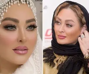 عمل بینی "الهام حمیدی" جوری که ندیدین؛ خانوم تا نترکونه دست بردار نیست!