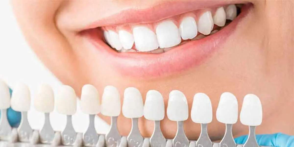 قیمت-لمینت-بالاتر-است-یا-کامپوزیت؟
