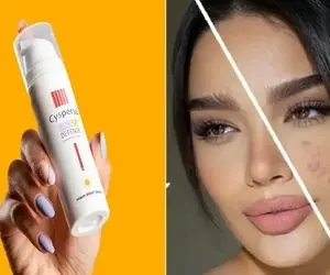 بهترین ضد آفتاب برا پوست جوش دار/ ضد آکنه، مناسب پوست مختلط تا چرب همراه با منافذ باز