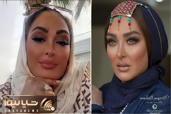 Elham hamidi shayanews