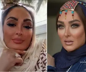 الهام حمیدی با مانتو جواهر دوزش چه شیک شده؛ خانم با این فیس شده سلطان بوتاکس!