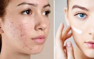 آگاه شو؛ 7 عادت که تو رو زشت میکنه! تقصیر ژنتیک ننداز