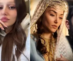 قبل و بعد تزریقات هانده ارچل / کیمیای مست عشق اینجوری شد جان و جهان شمس