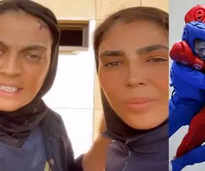 پدر عصبانی که سر خواهران منصوریان را شکست؛ هرکس قصه را یکجور تعریف می کند