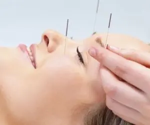 طب سوزنی چیست و آیا روش درمانی موثری است؟