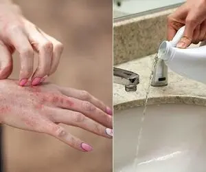 بهترین جایگزین ها به جای وایتکس / نه دستات داغون میشه نه لباس کثیف میشه نه مضره
