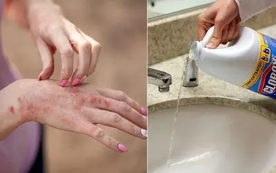 بهترین جایگزین ها به جای وایتکس / نه دستات داغون میشه نه لباس کثیف میشه نه مضره