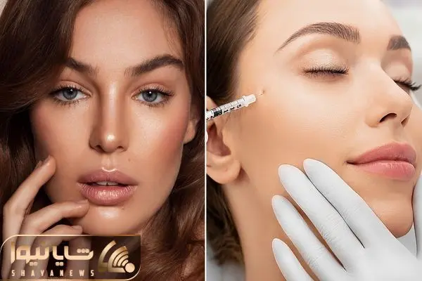 مزوژل چیست؟