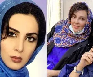 قبل و بعد لیلا بلوکات / نفرتیتی یوسف پیامبر تو بیست سالگی از مدلینگای زمانه اش بود