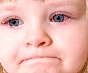 هشدار؛ کودکانتان در معرض این بیماری خطرناک چشمی هستند