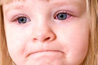 هشدار؛ کودکانتان در معرض این بیماری خطرناک چشمی هستند